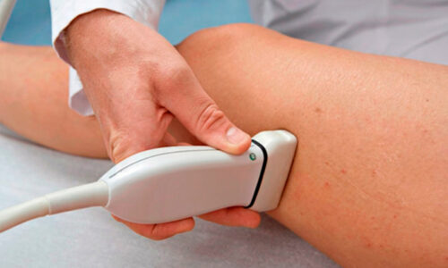 Extensão em Ecografia Vascular