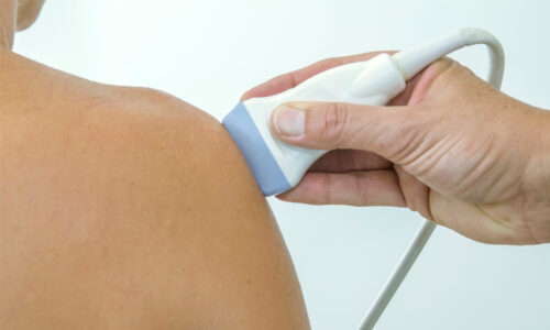 Ultrassonografia do Sistema Musculoesquelético