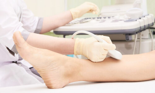 Exclusivo de Ecografia Vascular: Doppler Venoso De Membros Inferiores