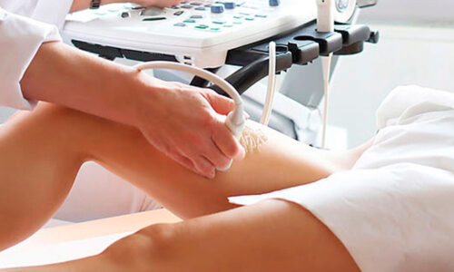 Exclusivo de Ecografia Vascular: Doppler Arterial de Membros Inferiores