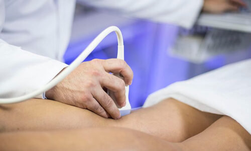 Exclusivo de Ecografia Vascular: Carótidas e Vertebrais, Arterial e Venoso Periférico