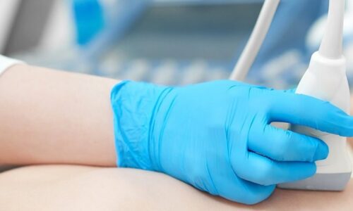 Intensivo de Ultrassonografia de Mama com Doppler